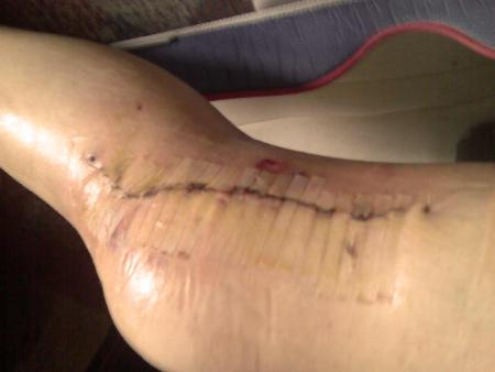 GROSSE PATATE!!!!!!!!!!!!!!